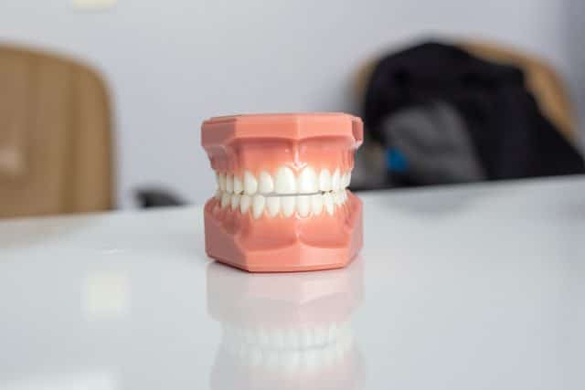 Implantes Dentales: La Solución Innovadora para Recuperar tu Sonrisa 4 Beneficios de la implantología oral en Sevilla