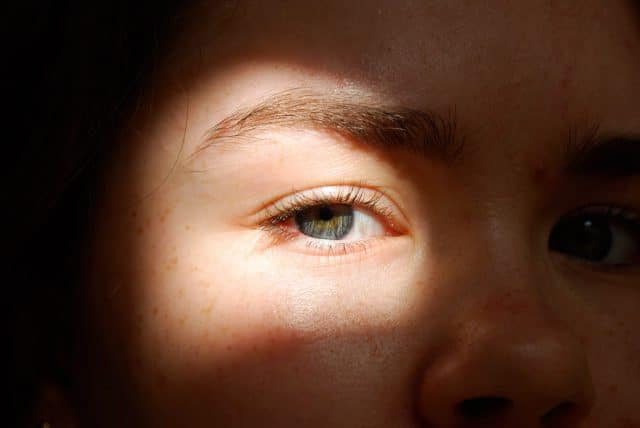 La Rosácea: Causas, Síntomas, Tratamientos y Consejos para su Manejo 5 rosacea y soluciones para tu piel